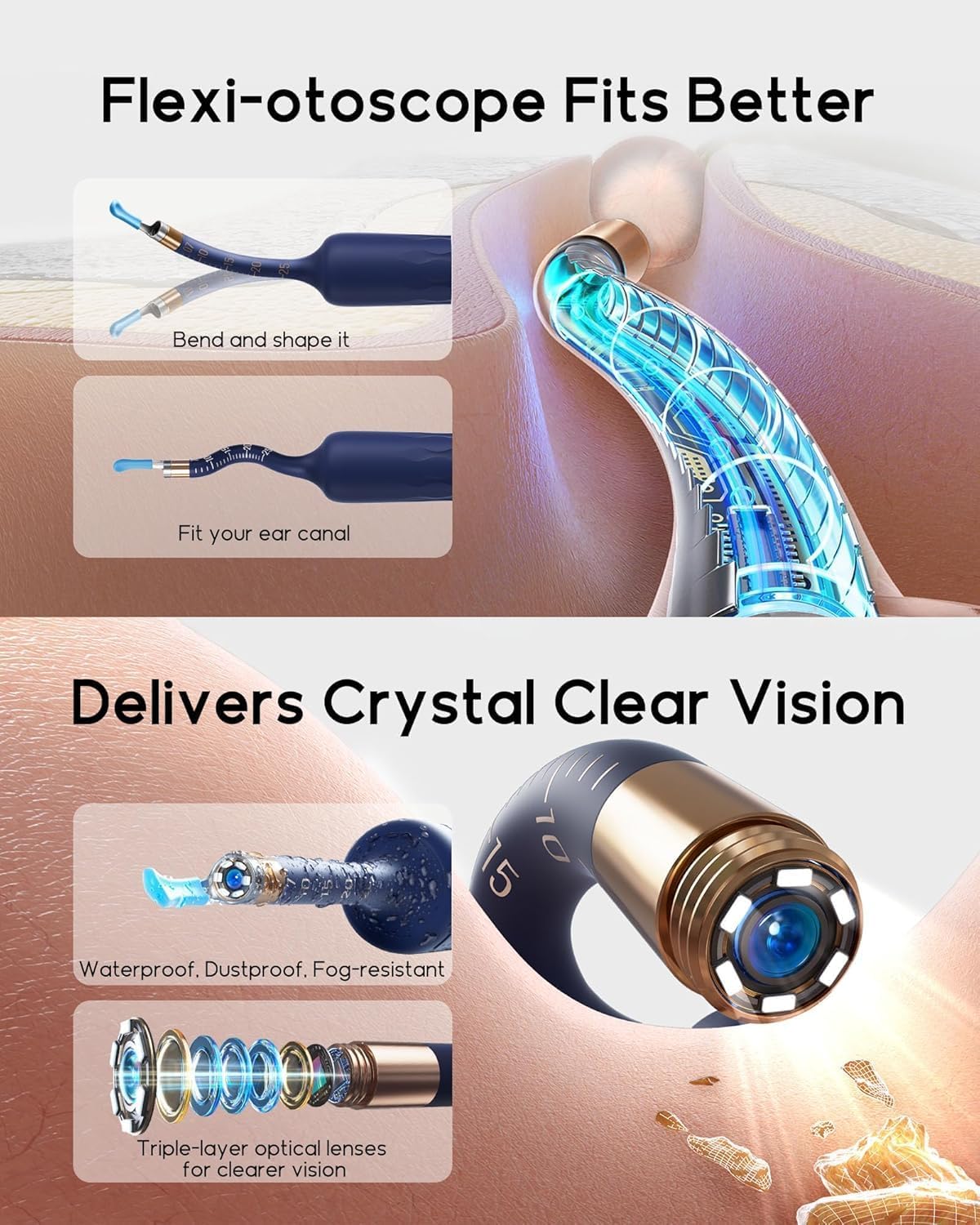 Earsight Plus D39R Ear Wax Removal Camera Otoscope, Visual Ear Cleaner Kit